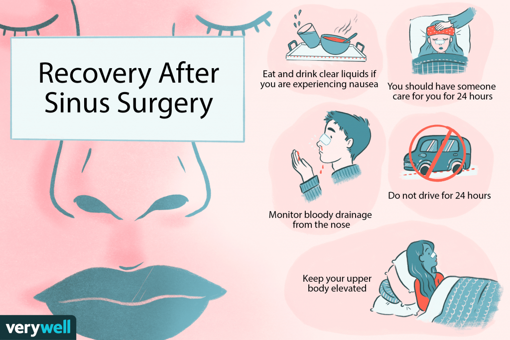 Recovery following sinus surgery